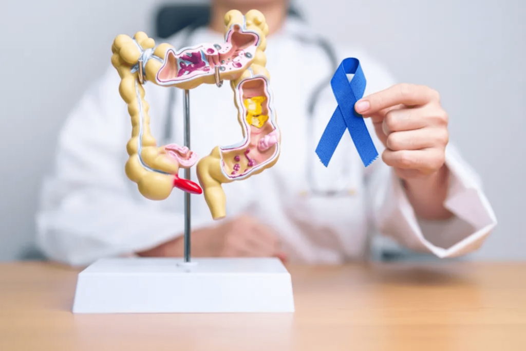 Colorectal Cancer Screening Gets a Boost with FDA-Approved Shield Blood Test